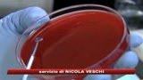 04/05/2009 - Influenza A, Oms: 26 morti confermati e 985 contagiati
