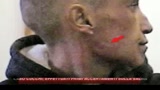 23/11/2009 - Caso Cucchi, effettuati i primi accertamenti su salma