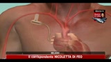Milano, impiantato il più piccolo cuore artificiale al mondo