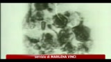 AIDS, 30 anni fa la scoperta del virus hiv