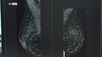 Cancro al seno, Health Triage sviluppa uno screening con I.A.