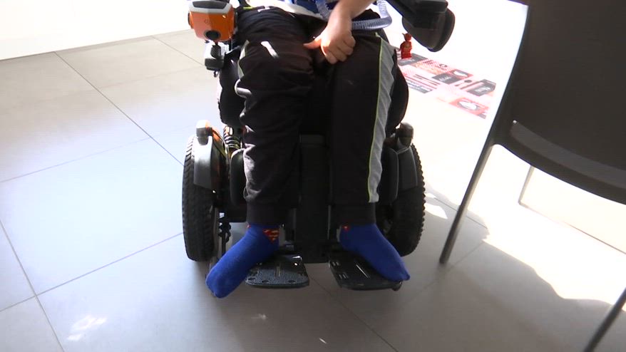 Milano, paraplegico torna a camminare al S. Raffaele
