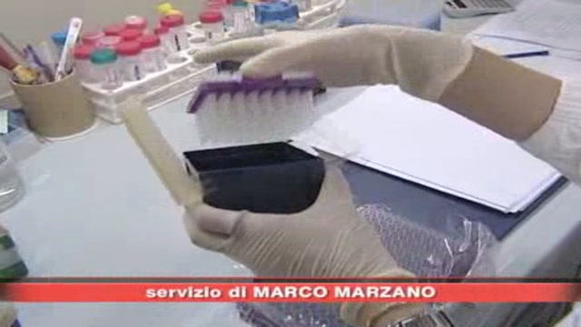 Aids, sperimentazione vaccino