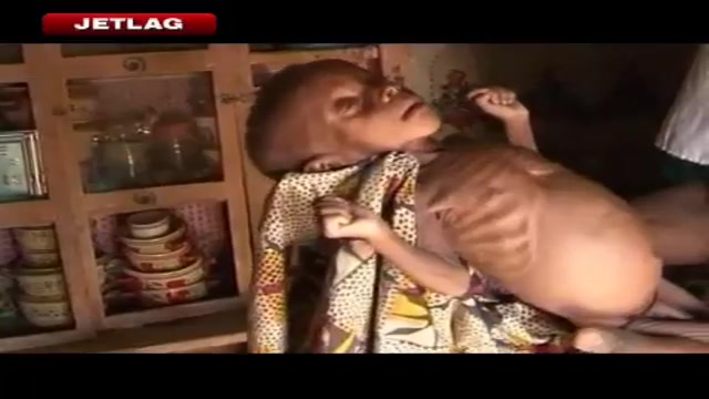 Jetlag: Niger alle prese con carestia, fame e crisi alimentare