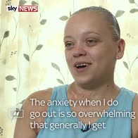 Victim still has nightmares of acid attack