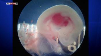 Creato in USA il primo embrione pecora-uomo