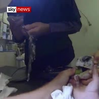 Turtle has plastic bag removed from throat
