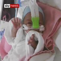 Tiny Japanese baby to go home after 5 months